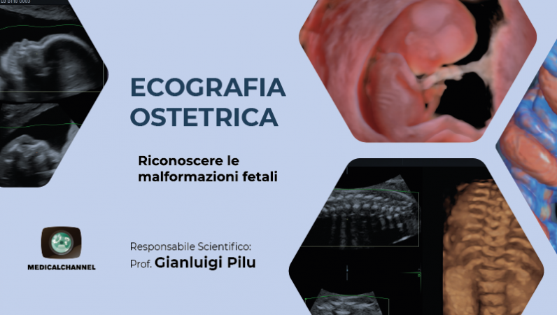 Ecografia ostetrica: riconoscere le malformazioni fetali